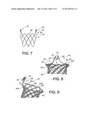 INTEGRATED STENT RETRIEVAL LOOP ADAPTED FOR SNARE REMOVAL AND/OR OPTIMIZED PURSE STRINGING diagram and image