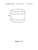 COMPOSITE IMPLANT diagram and image