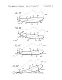 SHOE diagram and image