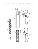 Selectively Coating Luminal Surfaces of Stents diagram and image