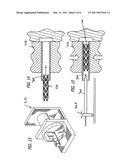 Selectively Coating Luminal Surfaces of Stents diagram and image