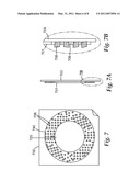 ABRASIVE ARTICLE WITH SOLID CORE AND METHODS OF MAKING THE SAME diagram and image