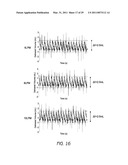 BROAD-BAND, LOW FREQUENCY, HIGH-AMPLITUDE, LONG TIME DURATION, OSCILLATING AIRWAY PRESSURE BREATHING APPARATUS AND METHOD UTILIZING BUBBLES diagram and image