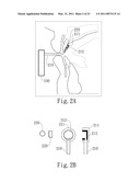 NEGATIVE PRESSURE ORAL APPARATUS diagram and image