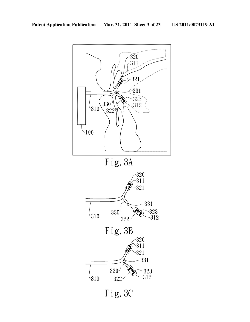 NEGATIVE PRESSURE ORAL APPARATUS - diagram, schematic, and image 04