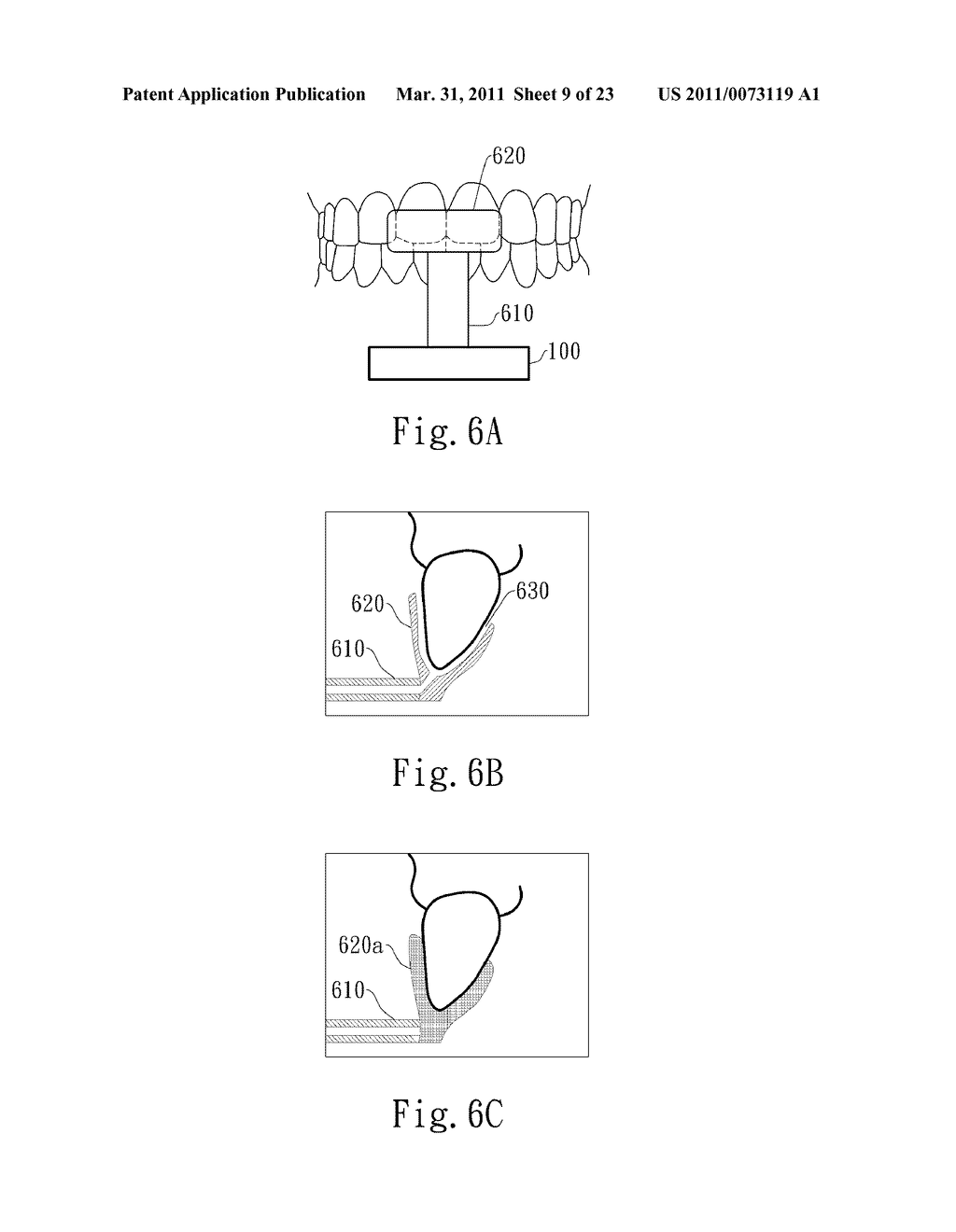 NEGATIVE PRESSURE ORAL APPARATUS - diagram, schematic, and image 10