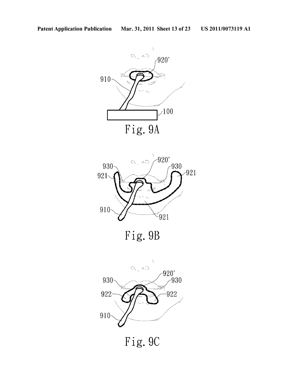 NEGATIVE PRESSURE ORAL APPARATUS - diagram, schematic, and image 14