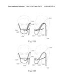 NEGATIVE PRESSURE ORAL APPARATUS diagram and image