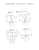 Golf club head cover and method of use diagram and image