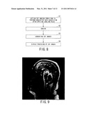 MAGNETIC RESONANCE IMAGING APPARATUS AND MAGNETIC RESONANCE IMAGING METHOD diagram and image