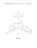 SLANTED BUMP DESIGN FOR MAGNETIC SHIELDS IN PERPENDICULAR WRITE HEADS AND METHOD OF MAKING SAME diagram and image