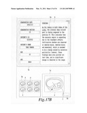 MEDICAL IMAGE INTERPRETING APPARATUS AND CURSOR-MOVING METHOD diagram and image