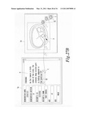 MEDICAL IMAGE INTERPRETING APPARATUS AND CURSOR-MOVING METHOD diagram and image