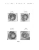 SYNERGISTIC PHARMACEUTICAL COMPOSITION USEFUL FOR INHIBITING CORNEAL AND RETINAL NEOVASCULARIZATION (ANGIOGENESIS), AND IN OTHER ORGANS, IN A HUMAN BEING OR ANIMALS diagram and image