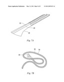 Grafts and Stents Having Inorganic Bio-Compatible Calcium Salt diagram and image