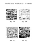 Grafts and Stents Having Inorganic Bio-Compatible Calcium Salt diagram and image