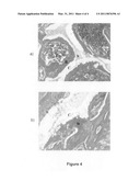 Method of forming a calcium phosphate coating within a porous material diagram and image