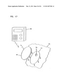 Analyte Monitoring Device and Methods of Use diagram and image