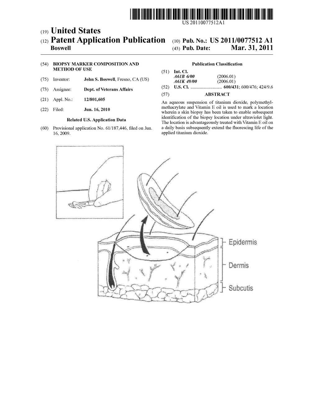 Biopsy marker composition and method of use - diagram, schematic, and image 01