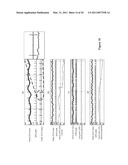 ELECTROCARDIOGRAM SIGNAL PROCESSING SYSTEM diagram and image