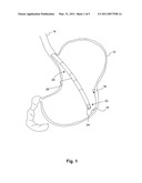 ULTRASOUND ENDOSCOPIC SYSTEM diagram and image