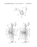 Telescopic Guide Device for Catheters to Facilitate Their Insertion Into the Human Cardiovascular System diagram and image