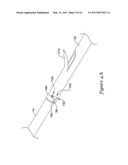 DELIVERY SYSTEM HAVING STENT LOCKING STRUCTURE diagram and image