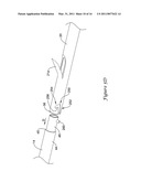 DELIVERY SYSTEM HAVING STENT LOCKING STRUCTURE diagram and image