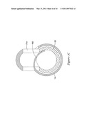 DELIVERY SYSTEM HAVING STENT LOCKING STRUCTURE diagram and image