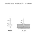 Management of Voltage Standing Wave Ratio at Skin Surface During Microwave Ablation diagram and image