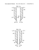 Energized Needles for Wound Sealing diagram and image