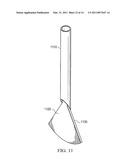 Energized Needles for Wound Sealing diagram and image