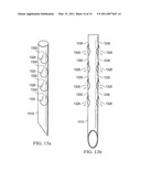 Energized Needles for Wound Sealing diagram and image