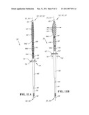 EXPANDABLE INTRAMEDULLARY ROD diagram and image