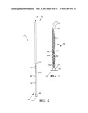 EXPANDABLE INTRAMEDULLARY ROD diagram and image