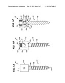 ANCHORING SYSTEMS AND METHODS FOR CORRECTING SPINAL DEFORMITIES diagram and image