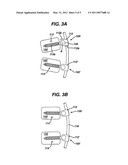 ANCHORING SYSTEMS AND METHODS FOR CORRECTING SPINAL DEFORMITIES diagram and image