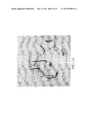 Method and Appartus for Extraction of Plant Embryos diagram and image