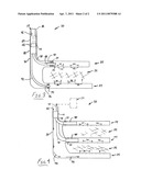 DOWNHOLE SEPARATION AND REINJECTION diagram and image