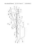 Device and method for treatment of canals diagram and image