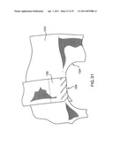 PASSIVE AIRBAG VENTING diagram and image