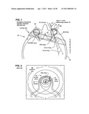 METHODS AND DEVICES FOR ORTHOVOLTAGE OCULAR RADIOTHERAPY AND TREATMENT PLANNING diagram and image