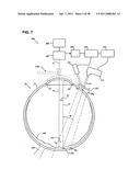 METHODS AND DEVICES FOR ORTHOVOLTAGE OCULAR RADIOTHERAPY AND TREATMENT PLANNING diagram and image