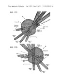 METHODS AND DEVICES FOR ORTHOVOLTAGE OCULAR RADIOTHERAPY AND TREATMENT PLANNING diagram and image