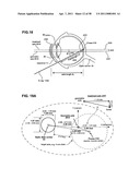 METHODS AND DEVICES FOR ORTHOVOLTAGE OCULAR RADIOTHERAPY AND TREATMENT PLANNING diagram and image