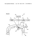 METHODS AND DEVICES FOR ORTHOVOLTAGE OCULAR RADIOTHERAPY AND TREATMENT PLANNING diagram and image