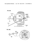 METHODS AND DEVICES FOR ORTHOVOLTAGE OCULAR RADIOTHERAPY AND TREATMENT PLANNING diagram and image