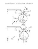 METHODS AND DEVICES FOR ORTHOVOLTAGE OCULAR RADIOTHERAPY AND TREATMENT PLANNING diagram and image