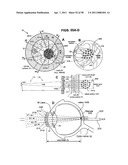 METHODS AND DEVICES FOR ORTHOVOLTAGE OCULAR RADIOTHERAPY AND TREATMENT PLANNING diagram and image