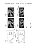 METHOD AND SYSTEM FOR FOUR DIMENSIONAL INTENSITY MODULATED RADIATION THERAPY FOR MOTION COMPENSATED TREATMENTS diagram and image